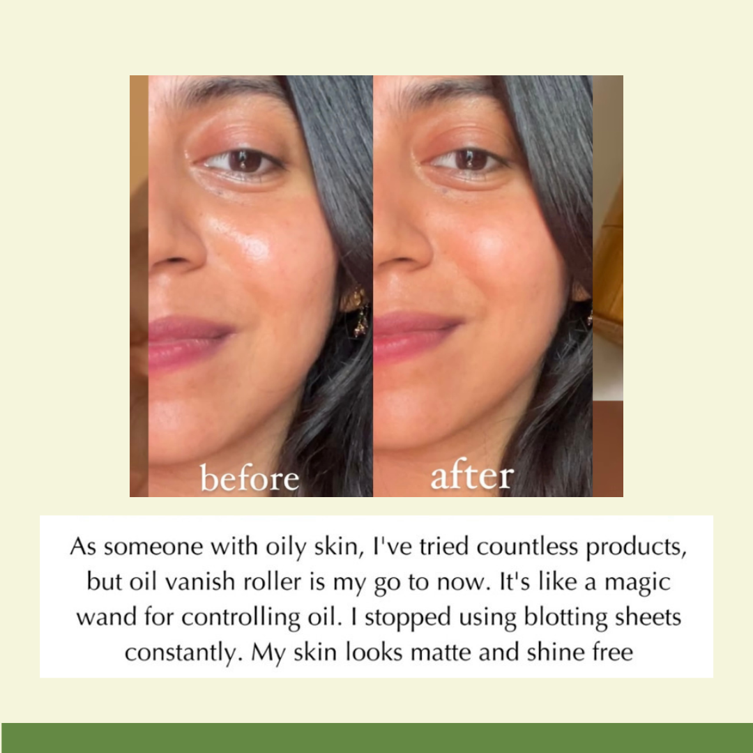 Oil Vanish Facial Roller
